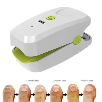 פטרת ציפורניים לייזר טיפול 905NM מכשיר לייזר 22W מסמר מנקה ציוד לטיפול הבוהן לאצבע פטרייתי מסיר פטרת הציפורניים